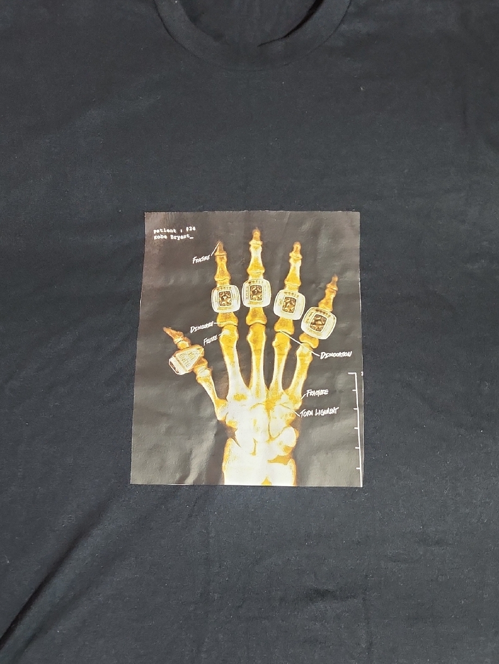 Kobe X-Ray Championship Rings Tshirt